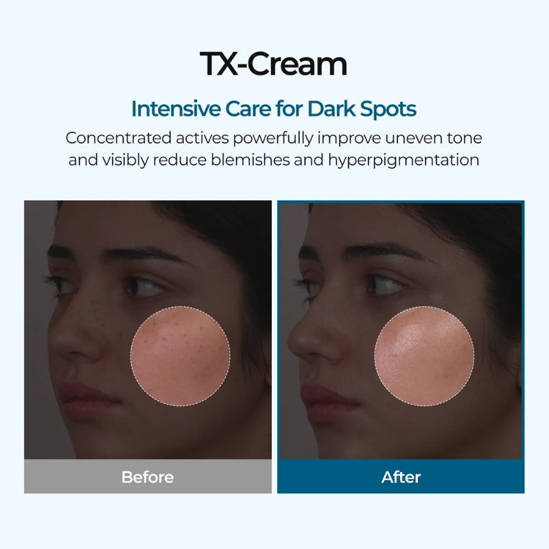 Dr. Melaxin - TX Cream 50ml