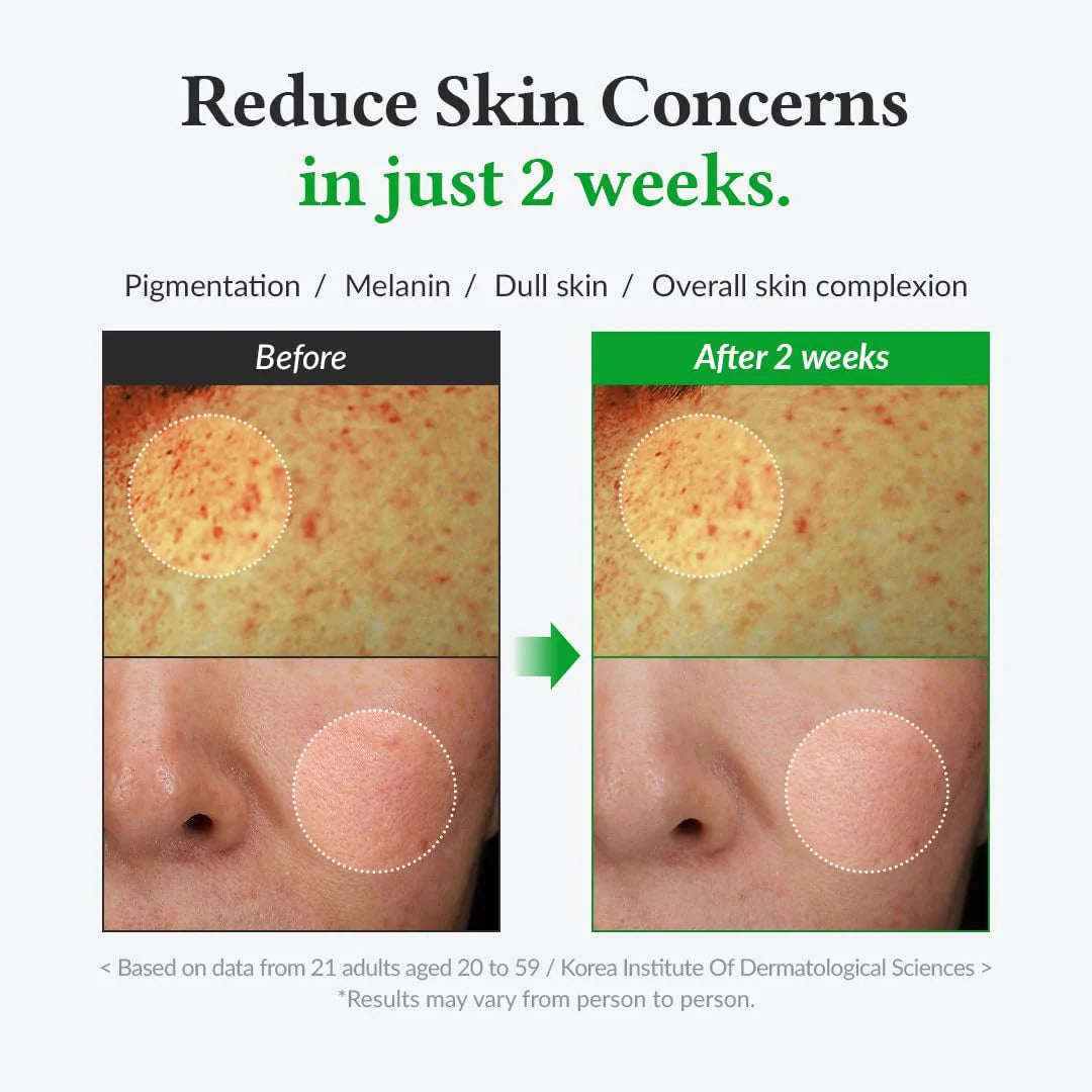 DR ALTHEA Gentle Vitamin C Serum 30ml