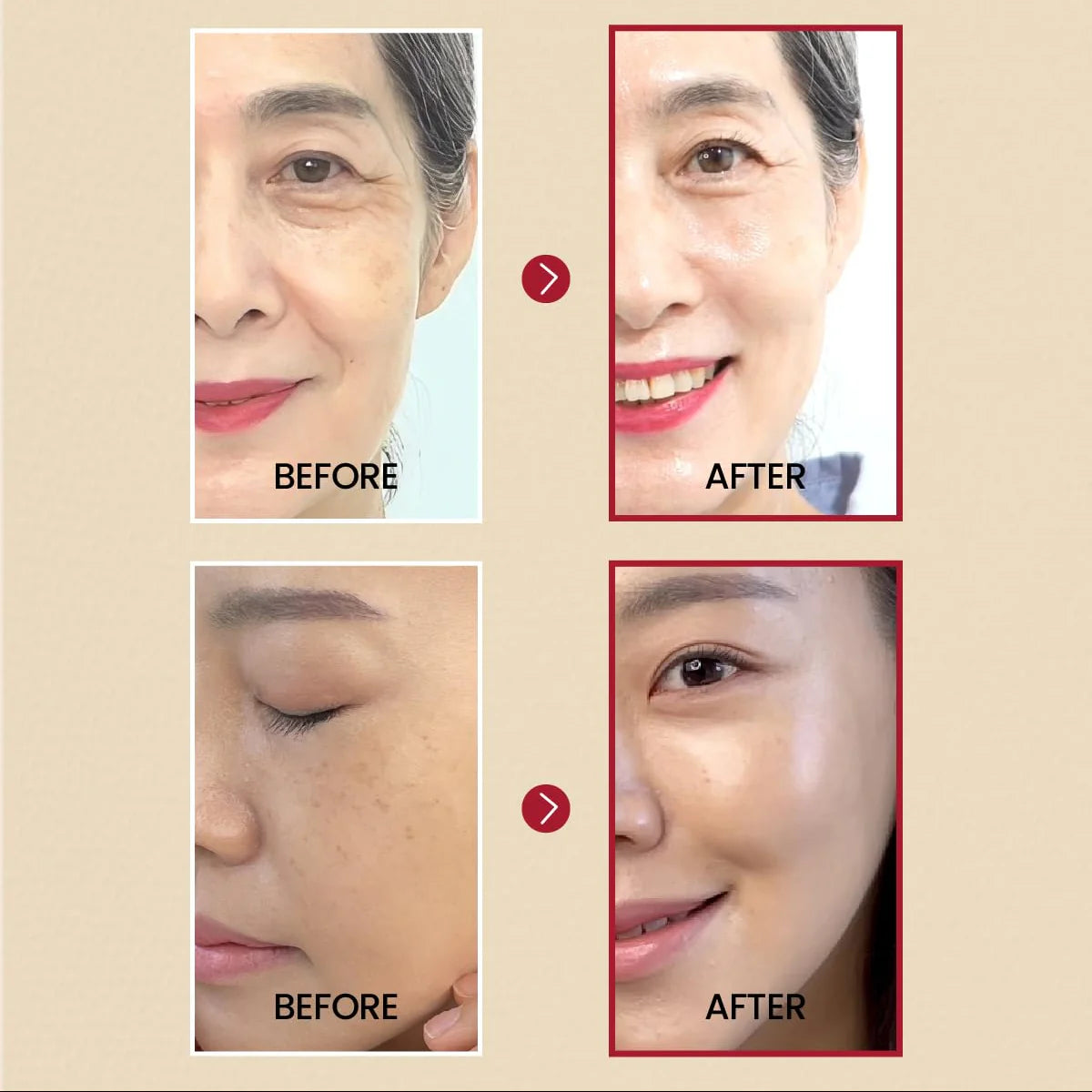 KSECRET 1988 Serum: Retinal Liposome 2% + Black Ginseng 30ml